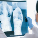 Dra. Thaline Neves conta como a descoberta dos raios-X revolucionou a medicina e deu origem à radiologia moderna.