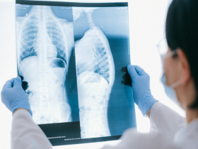 Dra. Thaline Neves conta como a descoberta dos raios-X revolucionou a medicina e deu origem à radiologia moderna.