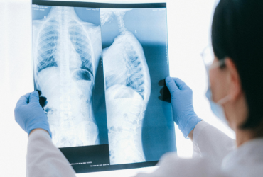 Dra. Thaline Neves conta como a descoberta dos raios-X revolucionou a medicina e deu origem à radiologia moderna.
