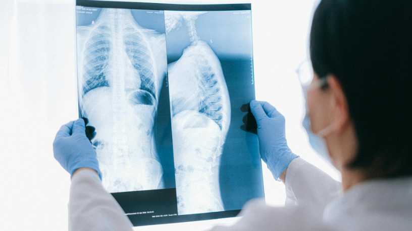 Dra. Thaline Neves conta como a descoberta dos raios-X revolucionou a medicina e deu origem à radiologia moderna.